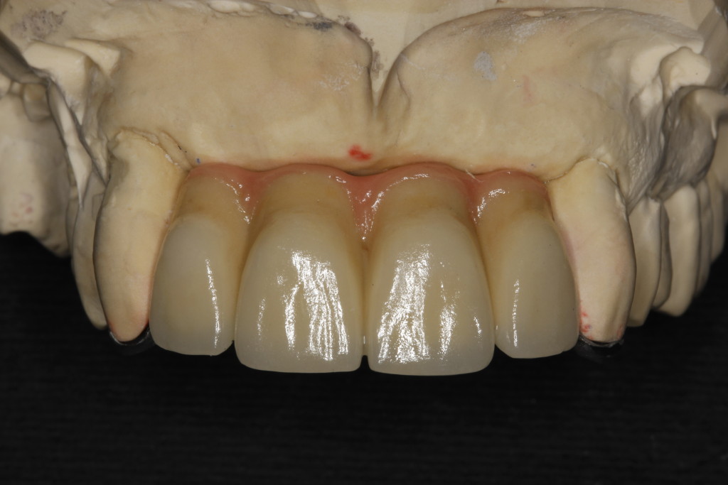 Restorative Dentistry | Deepa Shah